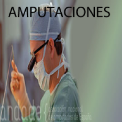 Amputaciones